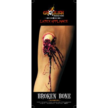 Appliance - Broken Bone